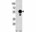 Western blot analysis of AKT2 antibody and 293 lysate transiently transfected with the human gene (2ug/lane). Predicted molecular weight: ~56kDa.