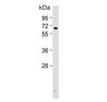 Western blot testing of human HACAT cell lysate with Cyclooxygenase 2 antibody. Predicted molecular weight ~69 kDa.