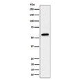 Western blot testing of human A431 cell lysate with SF3A3 antibody. Predicted molecular weight ~59 kDa.