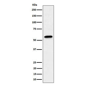 Western blot testing of human A431 cell lysate with SF3A3 antibody. Predicted molecular weight ~59 kDa.
