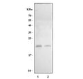Western blot testing of 1) rat testis and 2) mouse testis tissue lysate with Camp antibody. Predicted molecular weight ~20 kDa.