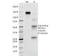 SDS-PAGE Analysis of Purified, BSA-Free Fas Antibody (B-R18). Confirmation of Integrity and Purity of the Antibody.