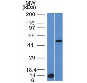 Western blot testing (A) recombinant protein and (B) human HepG2 cell lysate using Anaplastic Lymphoma Kinase antibody (clone ALK/1503). Predicted molecular weight ~180 kDa but may be observed at higher molecular weights due to glycosylation. Caspase 3 induced cleavage results in an ~60 kDa intracellular ALK fragment.