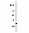Western blot testing of NOTCH4 antibody at 1:2000 dilution + human liver lysate; Predicted band size : 210 kDa.