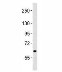 Western blot testing of NOTCH4 antibody at 1:2000 dilution + human liver lysate; Predicted band size : 210 kDa.