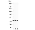 Western blot testing of SOCS3 antibody and Lane 1: Jurkat; 2: CEM; 3: Raji cell lysate. Predicted molecular weight ~24kDa.