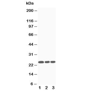 Western blot testing of SOCS3 antibody and Lane 1: Jurkat; 2: CEM; 3: Raji cell lysate. Predicted molecular weight ~24kDa.