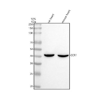 Western blot analysis of CCR1 using anti-CCR1 antibody. Lane 1: rat heart tissue lysates, Lane 2: mouse heart tissue lysates. After electrophoresis, proteins were transferred to a nitrocellulose membrane at 150 mA for 50-90 min. Blocked the membrane with 5% non-fat milk/TBS for 1.5 hour at RT.