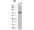 Western blot testing of human RH30 cell lysate with Catenin Beta antibody (clone CTNNB1/7759). Expected molecular weight: 85-95 kDa.