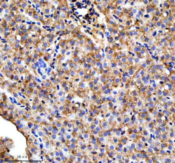 Immunohistochemical analysis of Ttc7b protein using Zebrafish Ttc7b antibody, HRP secondary and DAB substrate with paraffin-embedded zebrafish liver tissue. HIER: boil tissue sections in pH8 EDTA for 20 min and allow to cool before testing.