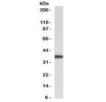 Western blot testing of human HeLa cell lysate with RAD51 antibody (clone RALPA-1). Expected molecular weight ~37 kDa.