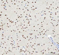 IHC staining of FFPE mouse brain tissue with TARDBP antibody. HIER: boil tissue sections in pH8 EDTA for 20 min and allow to cool before testing.