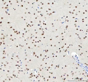 IHC staining of FFPE mouse brain tissue with TARDBP antibody. HIER: boil tissue sections in pH8 EDTA for 20 min and allow to cool before testing.