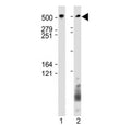 Western blot testing of BIRC6 antibody at 1:1000: Lane 1) huamn SH-SY5Y and 2) HeLa cell lysate. Predicted molecular weight ~530 kDa.