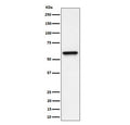 Western blot testing of human HeLa cell lysate with Regulator of G-protein signaling 6 antibody. Predicted molecular weight ~54 kDa.