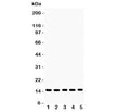 Western blot testing of Profilin-1 antibody and Lane 1: rat testis; 2: mouse testis; 3: human placenta; 4: (h) PANC; 5: (h) SW620 lysate. Expected molecular weight ~15 kDa.