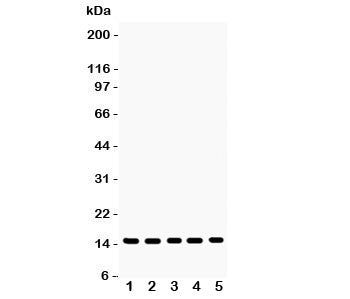 Western blot testing of Profilin-1 antibody and Lane 1: rat testis; 2: mouse testis; 3: human placenta; 4: (h) PANC; 5: (h) SW620 lysate. Expected molecular weight ~15 kDa.
