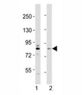 Western blot testing of DYRK1A antibody at 1:2000 dilution. Lane 1: mouse brain lysate; 2: HeLa lysate; Predicted molecular weight ~ 85 kDa.