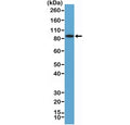 Western blot testing of human K562 cell lysate with recombinant BRAF antibody at 1:100 dilution. Predicted molecular weiight ~84 kDa.