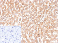 IHC staining of FFPE human liver tissue with recombinant BCL2L4 antibody (clone BAX/9925R). Inset: PBS used in place of primary Ab (secondary Ab negative control). HIER: boil tissue sections in pH 9 10mM Tris with 1mM EDTA for 20 min and allow to cool before testing.