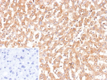 IHC staining of FFPE human liver tissue with recombinant BCL2L4 antibody (clone BAX/9925R). Inset: PBS used in place of primary Ab (secondary Ab negative control). HIER: boil tissue sections in pH 9 10mM Tris with 1mM EDTA for 20 min and allow to cool before testing.
