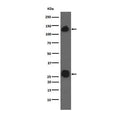 Western blot testing of human A549 cell lysate with Integrin alpha V antibody. Expected molecular weight: 116-150 kDa.