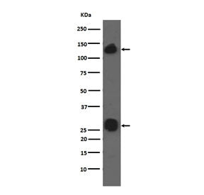 Western blot testing of human A549 cell lysate with Integrin alpha V antibody. Expected molecular weight: 116-150 kDa.
