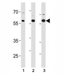 p65 antibody western blot analysis in (1) SK-BR-3, (2) mouse Neuro-2a cell line and (3) mouse testis tissue lysate.