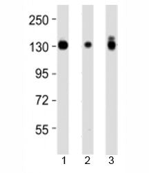 Western blot testing of Integrin alpha 3 antibody at 1:4000 dilution and 1) A431 lysate, 2) HeLa lysate, and 3) PC3 lysate at 1:2000. Expected molecular weight: 119-150 kDa depending on glycosylation level.