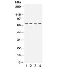 Western blot testing of human 1) HeLa, 2) COLO320, 3) HT1080 and 4) PANC cell lysate with Kv1.4 antibody. Expected/observed molecular weight ~73 kDa.