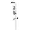 Western blot testing of hamster CHO cell lysate with RPL27A antibody. Predicted molecular weight ~17 kDa.