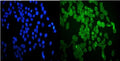 Immunofluorescent staining of FFPE human A431 cells with HSP20 antibody (green) and DAPI nuclear stain (blue). HIER: steam section in pH6 citrate buffer for 20 min.