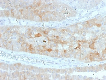 IHC staining of FFPE human kidney with ROR2 antibody. HIER: boil tissue sections in pH 9 10mM Tris with 1mM EDTA for 20 min and allow to cool before testing.