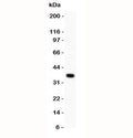 Western blot testing of WNT4 antibody and MCF-7 lysate. Expected molecular weight: 35~46 kDa depending on glycosylation level.