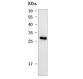 Western blot testing of rat liver tissue lysate with Mis18b antibody. Predicted molecular weight ~25 kDa.
