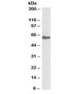 Western blot testing of human kidney lysate with GGT1 antibody at 0.1ug/ml. Predicted molecular weight ~61kDa.