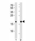 Western blot analysis of lysate from (1) human HepG2 and (2) mouse NIH3T3 cell lines using Hmga2 antibody at 1:1000. Predicted molecular weight ~12kDa but routinely observed at ~18kDa.