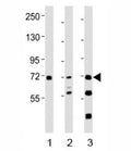 Western blot testing of SYK antibody at 1:2000 dilution. Lane 1: THP-1 lysate; 2: Ramos lysate; 3: mouse spleen lysate; Predicted molecular weight: 72 kDa.