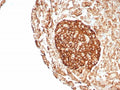 IHC staining of FFPE human pancreas tissue with CD99 antibody (clone rMIC2/8746). HIER: boil tissue sections in pH 9 10mM Tris with 1mM EDTA for 20 min and allow to cool before testing.