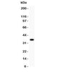 Western blot testing of FGF-1 antibody and recombinant human protein (0.5ng)