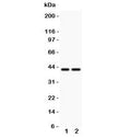 Western blot testing of CD244 antbody and Lane 1: human MCF-7; 2: human HeLa lysate.