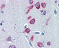 IHC testing of FFPE human cerebral cortex with PCK1 antibody at 2ug/ml. HIER: steamed with pH6 citrate buffer, AP-staining.