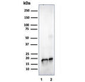 Western blot testing of human 1) JEG-3 and 2 )LNCaP cell lysate using SOD1 antibody (clone SOD1/4329). Predicted molecular weight ~16 kDa.