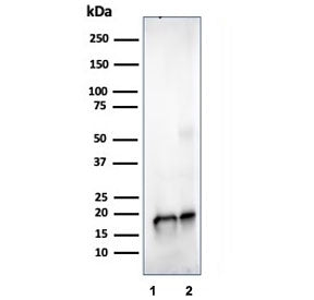 Western blot testing of human 1) JEG-3 and 2 )LNCaP cell lysate using SOD1 antibody (clone SOD1/4329). Predicted molecular weight ~16 kDa.