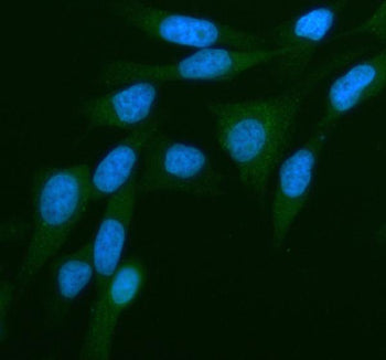Immunofluorescent staining of PKN3 using anti-PKN3 antibody (green). PKN3 was detected in an immunocytochemical section of HELA cells. Enzyme antigen retrieval was performed using IHC enzyme antigen retrieval reagent for 15 mins. The cells were blocked with 10% goat serum. And then incubated with 5 ug/ml rabbit anti-PKN3 antibody overnight at 4oC. DyLight 488 Conjugated Goat Anti-Rabbit IgG was used as secondary antibody at 1:500 dilution and incubated for 30 min at 37oC.