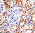 IHC staining of FFPE human kidney tissue with Phospho-Tau antibody, HRP-secondary and DAB substrate. HIER: boil tissue sections in pH8 EDTA for 20 min and allow to cool before testing.