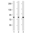 Western blot testing of human 1) HEK293, 2) HT-29 and 3) U-2 OS cell lysate with ADD1 antibody at 1:2000. Predicted molecular weight ~81 kDa.