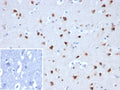 IHC staining of FFPE human cerebellum tissue with RBFOX3antibody (clone NEUN/8096R). Inset: PBS used in place of primary Ab (secondary Ab negative control). HIER: boil tissue sections in pH 9 10mM Tris with 1mM EDTA for 20 min and allow to cool before testing.