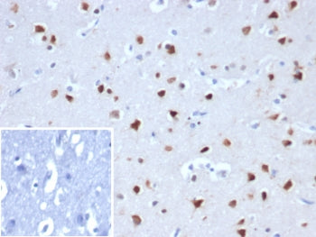 IHC staining of FFPE human cerebellum tissue with RBFOX3antibody (clone NEUN/8096R). Inset: PBS used in place of primary Ab (secondary Ab negative control). HIER: boil tissue sections in pH 9 10mM Tris with 1mM EDTA for 20 min and allow to cool before testing.