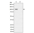 Western blot testing of lysate from human 293T cells, untreated (1) and Lambda Phosphatase treated (2), with Phospho-Nucleolin antibody.